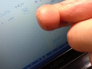 手荒れまくり~